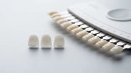 Three veneer samples — porcelain, E-max and zirconia — lined up next to a dental shade guide