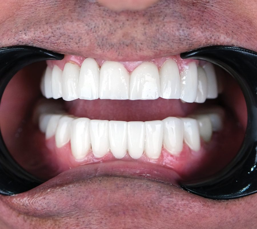 vdsdentalclinic_481941888_122223158714208469_3480567986558730170_n vdsdentalclinic_481941888_122223158714208469_3480567986558730170_n