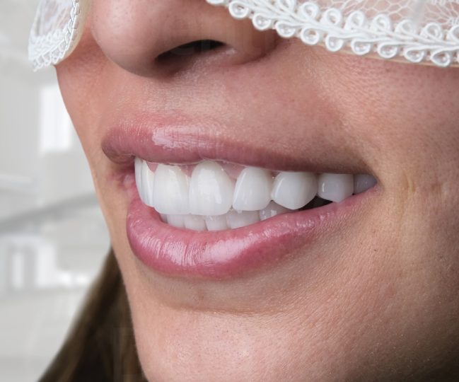 vdsdentalclinic_482082906_122224474814208469_4908112382128256740_n vdsdentalclinic_482082906_122224474814208469_4908112382128256740_n