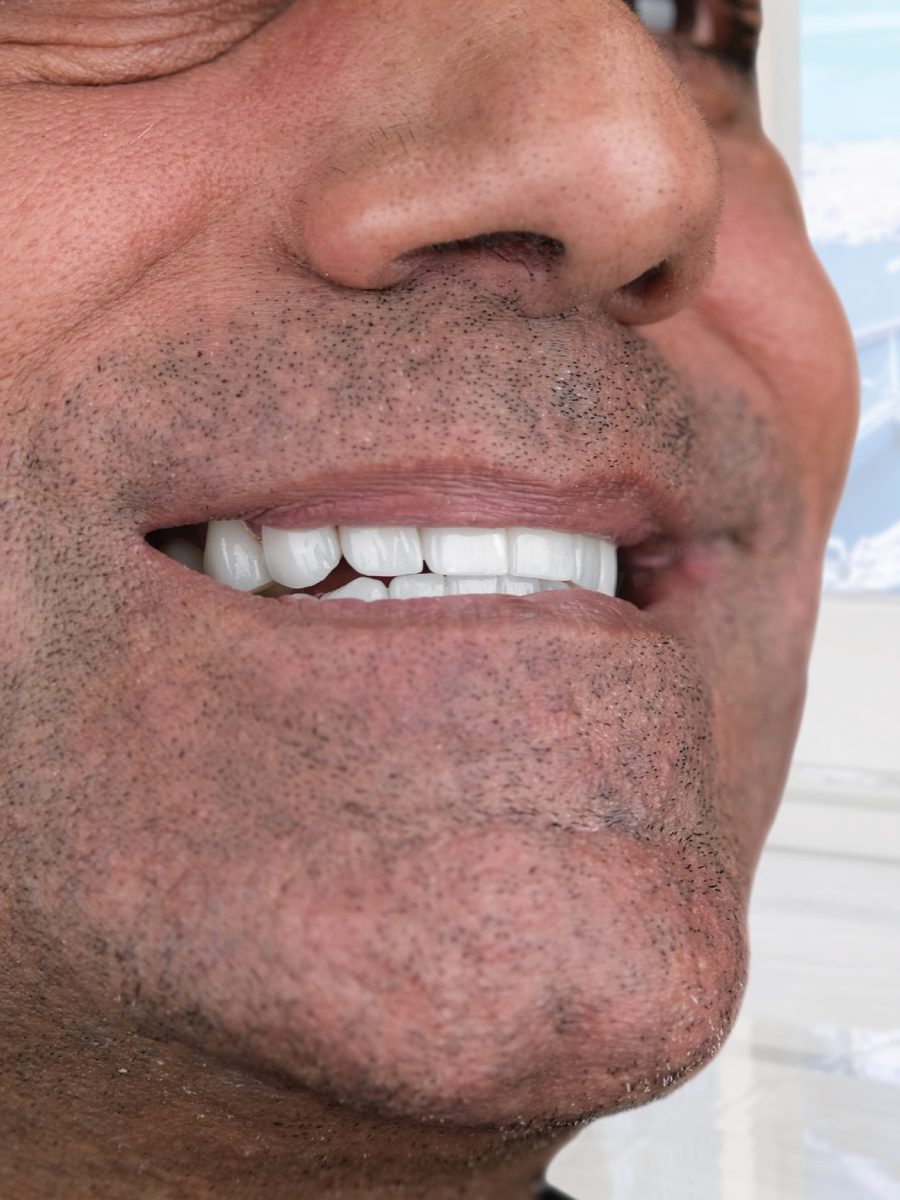 vdsdentalclinic_484316718_122224462382208469_2279821516553522506_n vdsdentalclinic_484316718_122224462382208469_2279821516553522506_n