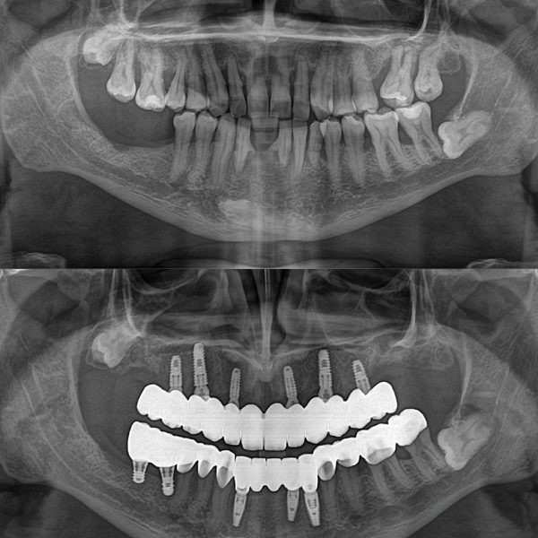 vdsdentalclinic_484403472_122224620314208469_6448985332146475682_n