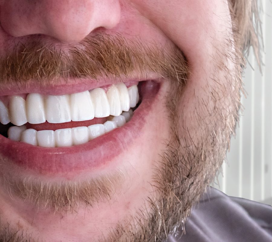 vdsdentalclinic_485695420_122226931250208469_3834524008330307181_n vdsdentalclinic_485695420_122226931250208469_3834524008330307181_n