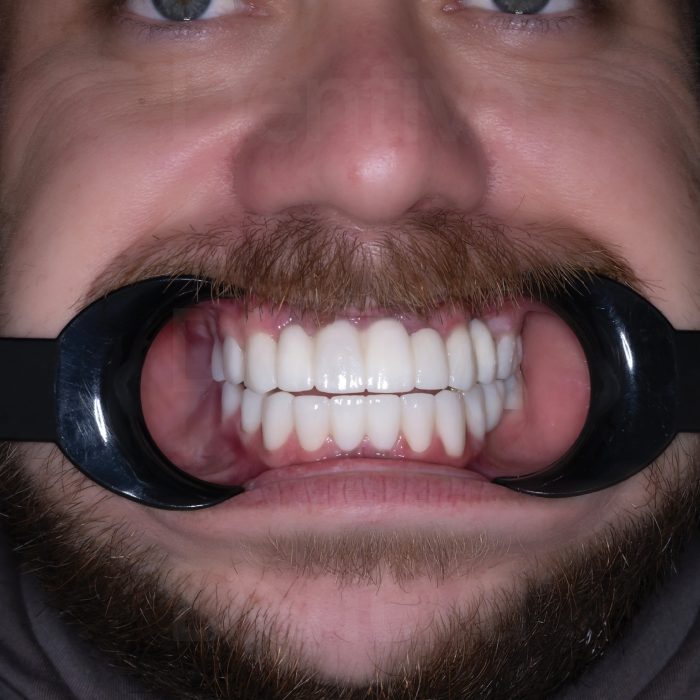 vdsdentalclinic_485994610_122226931526208469_7505855889541680157_n