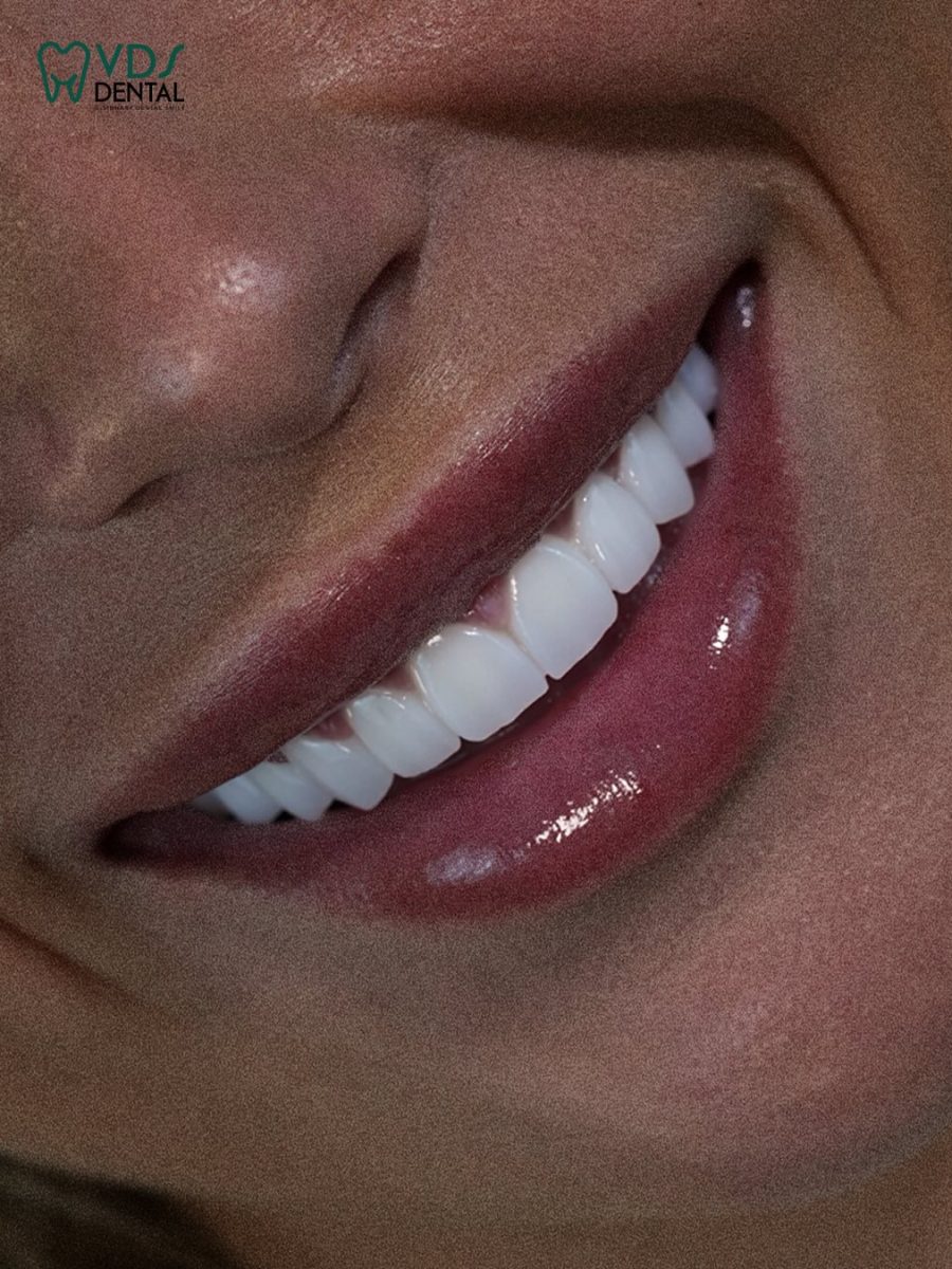 vdsdentalclinic_497007174_17930969988044961_197975380501188664_n vdsdentalclinic_497007174_17930969988044961_197975380501188664_n