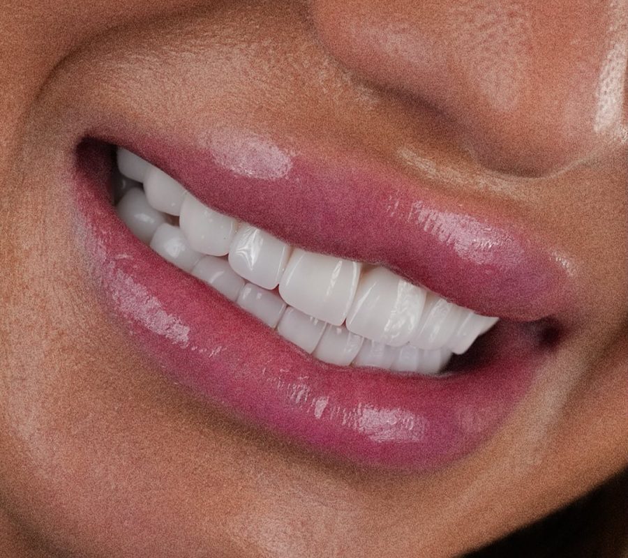 vdsdentalclinic_502969986_17933478048044961_4681534002004274993_n vdsdentalclinic_502969986_17933478048044961_4681534002004274993_n